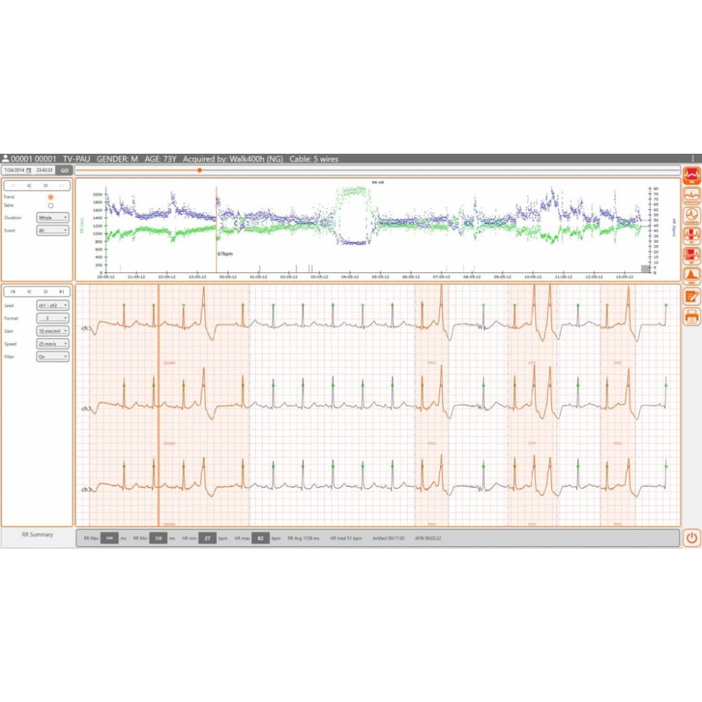 SOFTWARE PER HOLTER ECG  “CUBEHOLTER“ CARDIOLINE PER ANALISI